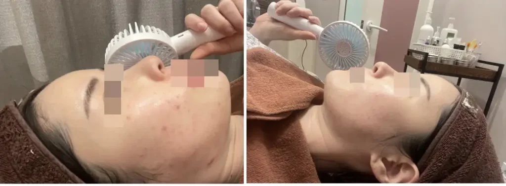 네오빔 후기
