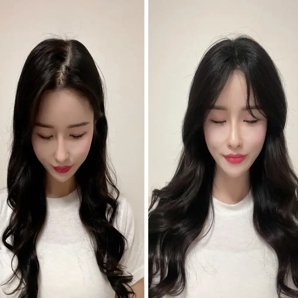 여자탈모 가발
