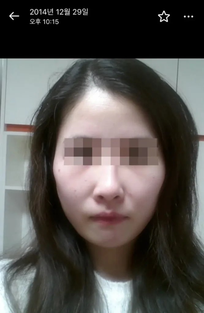 먹토 얼굴형
