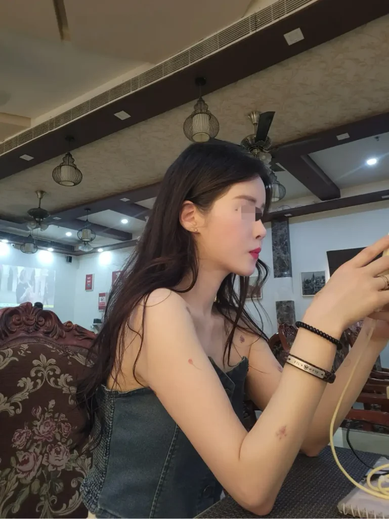 먹토 얼굴형 돌아옴
