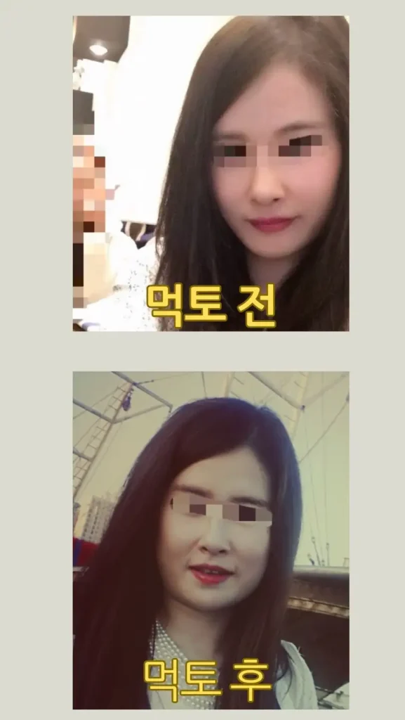 먹토 얼굴형 전후