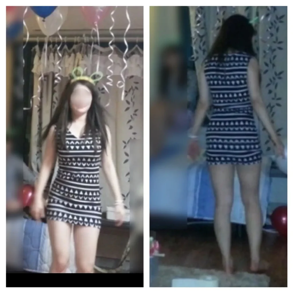 식이장애 시절 모습