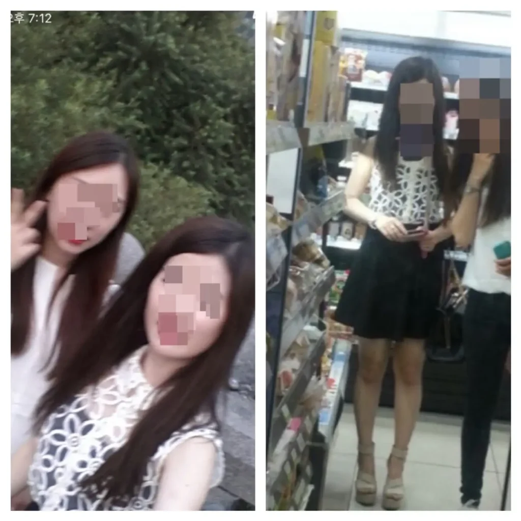 식이장애 얼굴 부음